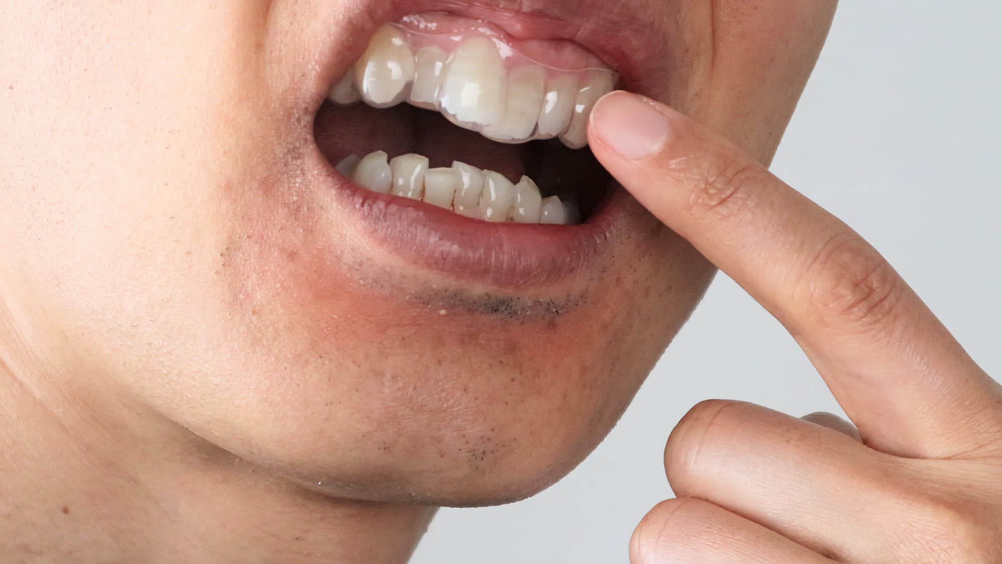 浮いたマウスピースを指で触るイメージ