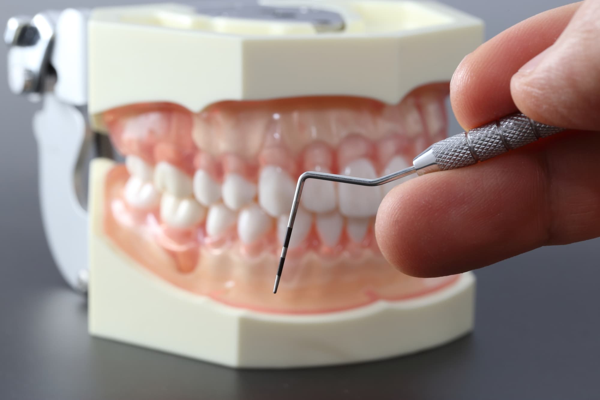 歯周ポケットを計る様子