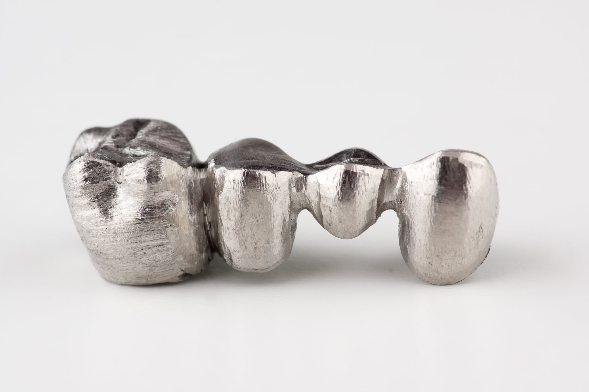 保険適用となる銀歯のブリッジ