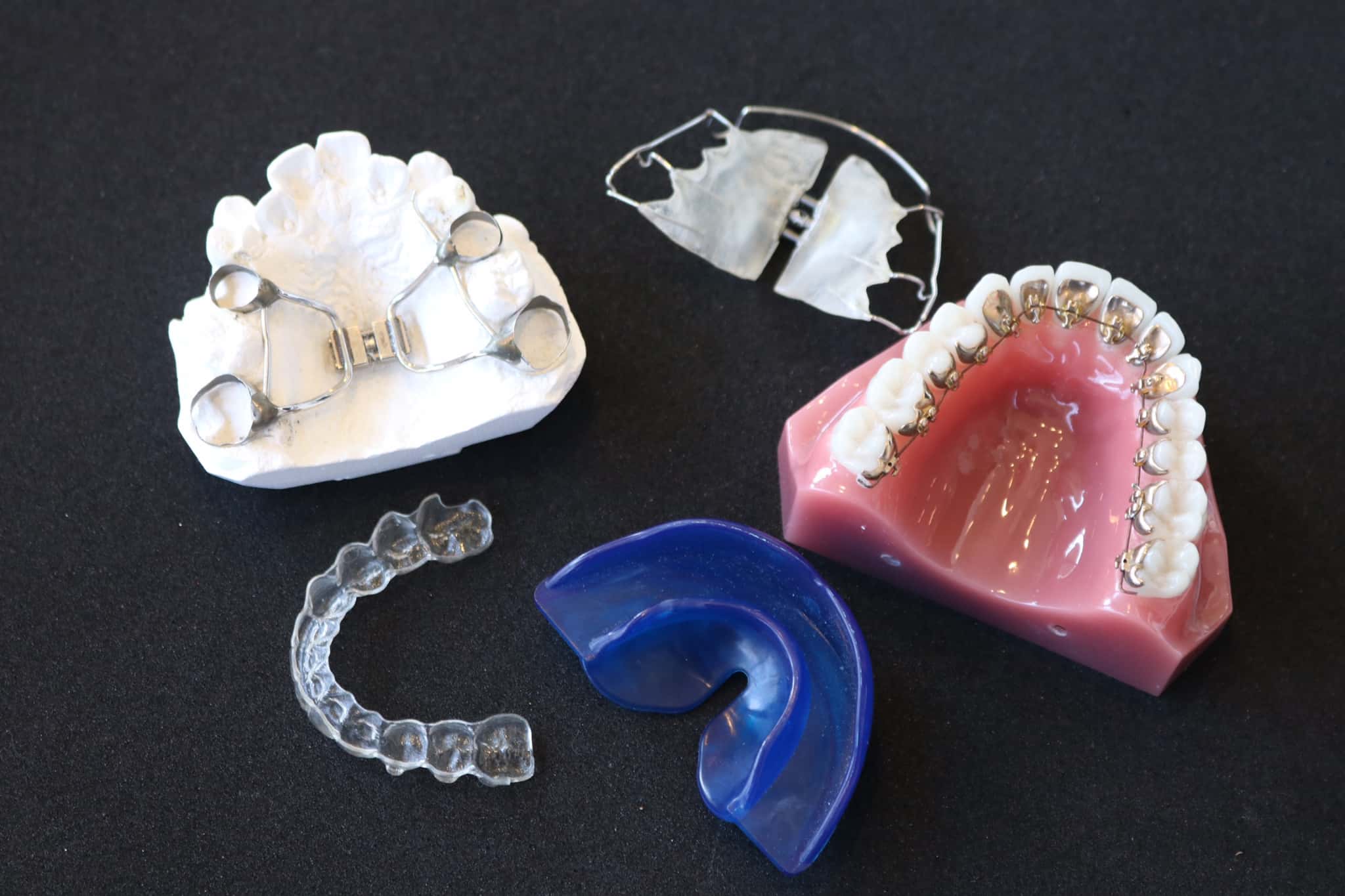 子どもの歯並びを矯正するワイヤー矯正など色々な装置